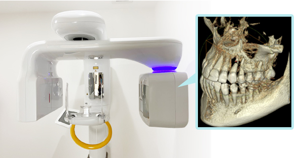 歯科用CT